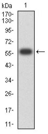CD1B Primary Antibody MP31418 [M5G3D4]