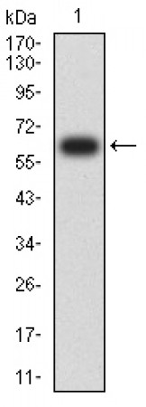CD30 Primary Antibody  MP31660 [M2C5G5]
