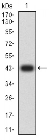 KMT2A Primary Antibody MP31671  [M4A5A12]