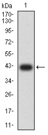 KAT6B Primary Antibody  MP31677 [M8C8D12]