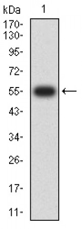 SETD7 Primary Antibody  MP31679 [M1B3B8]