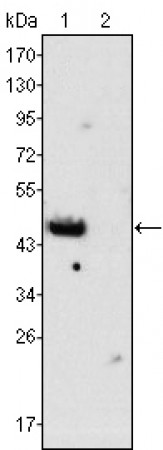 GATA4 Primary Antibody MP20361 [M6H10]