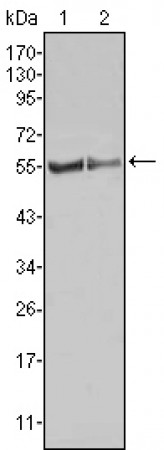 FGR Primary Antibody MP20318 [M6G2]