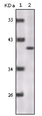 Human P16 Primary Antibody MP20137 [M5A8A4; 3G8D12]