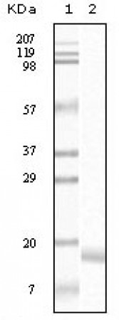 SNCA Primary Antibody MP20077 [M2B2D1]
