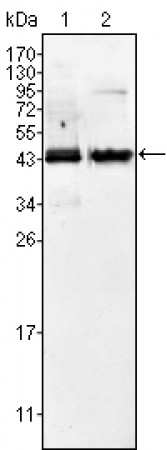 AMACR Primary Antibody MP20155 [M2A10F3]