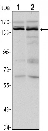 KDM3A Primary Antibody MP30134 [M2E1]