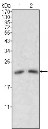 ApoM Primary Antibody MP20116 [M8F12C6B8]