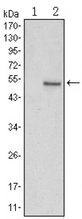 SUZ12 Primary Antibody MP30142 [M2C11]