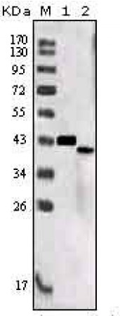 SORL1 Primary Antibody MP20164 [M7D7B11]