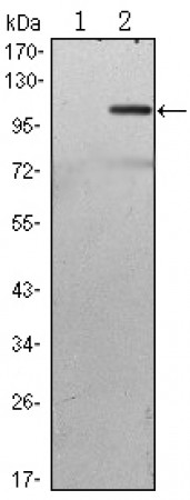 TAB2 Primary Antibody MP30123 [M3B5]