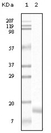 SNCG (breast cancer-specific protein 1) Primary Antibody MP20084 [M1H10D2]