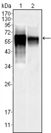 MAPK10 Primary Antibody MP20207 [M10E4A4]