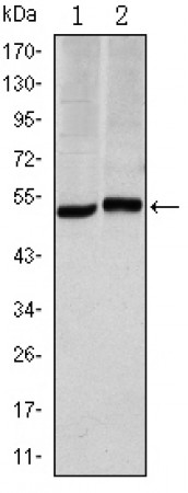 CA9 Primary Antibody MP30148 [M2D3]