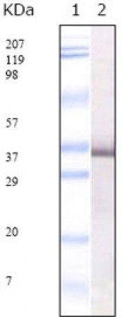 SARS-E2 Primary Antibody MP20018 [M4A6C9]