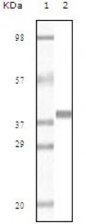 Myoglobin Primary Antibody MP20093 [M5A2G8]