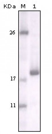 DDR2 Primary Antibody MP20151 [M3B11E4]