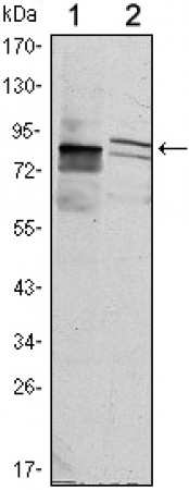 KLHL11 Primary Antibody MP30069 [M1B9A8]