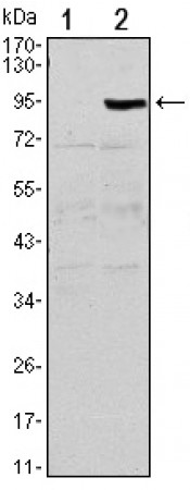 TNFRSF11B Primary Antibody MP30136 [M5A11]