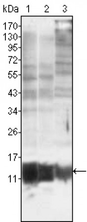 S100A10/P11 Primary Antibody MP20120 [M4E7E10]