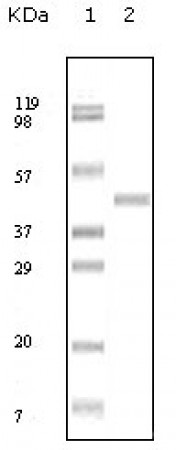 ABL2 Primary Antibody MP20125 [M1H1B11]
