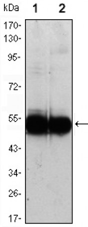VCAM1 Primary Antibody MP30045 [M6G9]