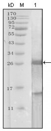 PSA (KLK3) Primary Antibody MP20172 [M5A11E2]