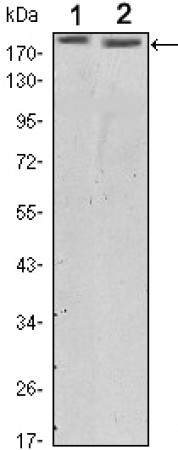ERBB2 Primary Antibody MP30112 [M6C2]