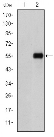 CD105 Primary Antibody MP30221 [M3A9]
