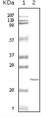 cTnI Primary Antibody MP20050 [M3A10A12]