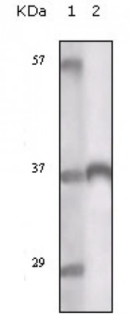 TYRO3 Primary Antibody MP20135 [M1C10E8]