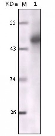 Cytokeratin (Pan) Primary Antibody MP20143 [M7H8C4]