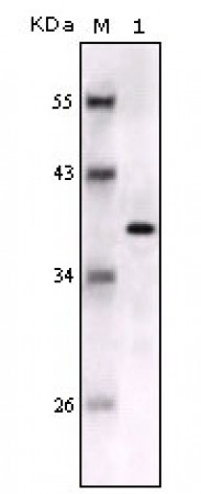 S100B Primary Antibody MP20154 [M9A11B9]