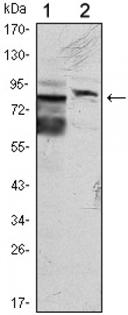 KLHL11 Primary Antibody MP30070 [M1B9C1]