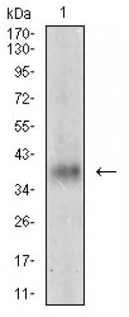 MSTN Primary Antibody MP30626 [M6E4B2]