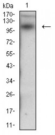 DSG3 Primary Antibody MP30627 [M6G2C11]