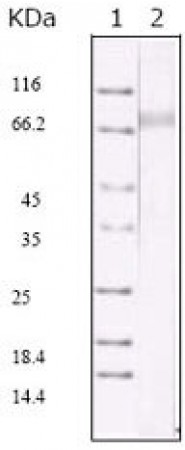 KSHV ORF45 Primary Antibody MP20016 [M2D4A5]