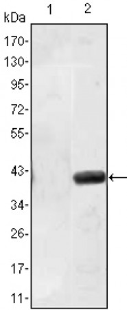 MATN1 Primary Antibody MP30114 [M5A8]