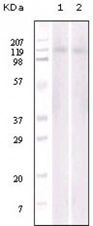 EphB6 Primary Antibody MP20063 [M8E7H12]