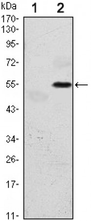 EIF2AK3 Primary Antibody MP30115 [M5G5]