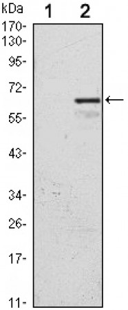 CDKN1C Primary Antibody MP30130 [M3E3]