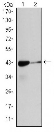 ACTA2 Primary Antibody MP30163 [M4F4]