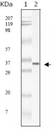 SARS-M Primary Antibody MP20019 [M2H2C4]