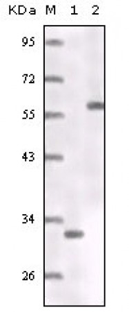 ER Primary Antibody MP20139 [M5D4B1]