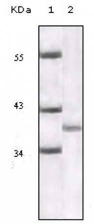 P16 (Mouse and Human) Primary Antibody MP20129 [M2D9A12]
