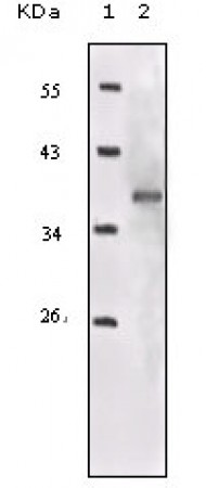 IGF1R-Beta Primary Antibody MP20149 [M3G5C1]