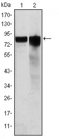 GYS1 Primary Antibody MP30159 [M3A7]