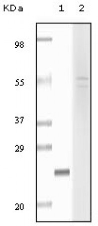 Fibulin 5 Primary Antibody MP20080 [M3F8D5]