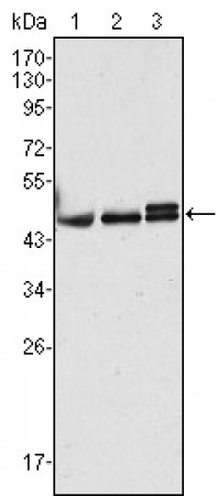 CK17 Primary Antibody MP20363 [M3B12]