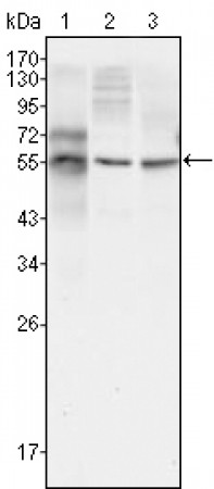 TUBB3 Primary Antibody MP20374 [M2E9]